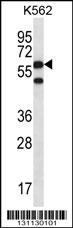 CCT8 Antibody (C-term) (Cat. #AP12500b) western blot analysis in K562 cell line lysates (35ug/lane).This demonstrates the CCT8 antibody detected the CCT8 protein (arrow).