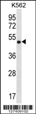 CCDC71 Antibody (C-term) (Cat. #AP12481b) western blot analysis in K562 cell line lysates (35ug/lane).This demonstrates the CCDC71 antibody detected the CCDC71 protein (arrow).