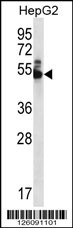 WDR85 Antibody (N-term) (Cat. #AP12477a) western blot analysis in HepG2 cell line lysates (35ug/lane).This demonstrates the WDR85 antibody detected the WDR85 protein (arrow).