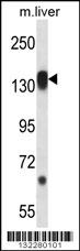 RPS6KC1 Antibody (N-term) (Cat. #AP12461a) western blot analysis in mouse liver tissue lysates (35ug/lane).This demonstrates the RPS6KC1 antibody detected the RPS6KC1 protein (arrow).