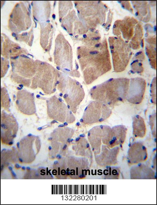 RPS6KC1 Antibody (N-term) (Cat. #AP12461a)immunohistochemistry analysis in formalin fixed and paraffin embedded human skeletal muscle followed by peroxidase conjugation of the secondary antibody and DAB staining.This data demonstrates the use of RPS6KC1 Antibody (N-term) for immunohistochemistry. Clinical relevance has not been evaluated.