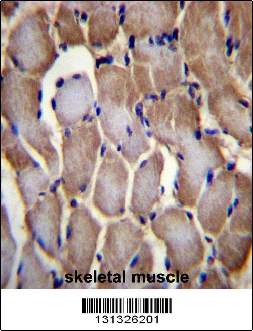 SEPN1 Antibody (C-term) (Cat. #AP12452b)immunohistochemistry analysis in formalin fixed and paraffin embedded human skeletal muscle followed by peroxidase conjugation of the secondary antibody and DAB staining.This data demonstrates the use of SEPN1 Antibody (C-term) for immunohistochemistry. Clinical relevance has not been evaluated.