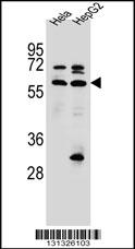 SEPN1 Antibody (C-term) (Cat. #AP12452b) western blot analysis in Hela,HepG2 cell line lysates (35ug/lane).This demonstrates the SEPN1 antibody detected the SEPN1 protein (arrow).