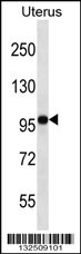 FGD4 Antibody (N-term) (Cat. #AP12983a) western blot analysis in human normal Uterus tissue lysates (35ug/lane).This demonstrates the FGD4 antibody detected the FGD4 protein (arrow).