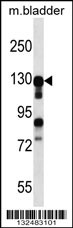 MKL2 Antibody (N-term) (Cat. #AP12979a) western blot analysis in mouse bladder tissue lysates (35ug/lane).This demonstrates the MKL2 antibody detected the MKL2 protein (arrow).
