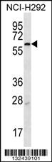 MBTPS2 Antibody (N-term) (Cat. #AP12972a) western blot analysis in NCI-H292 cell line lysates (35ug/lane).This demonstrates the MBTPS2 antibody detected the MBTPS2 protein (arrow).