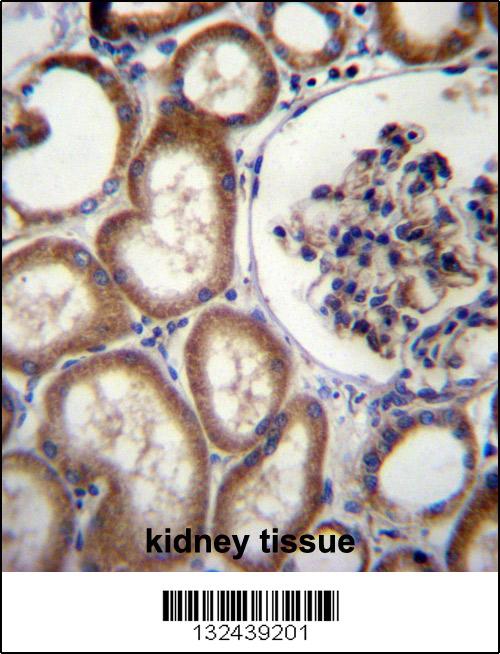 MBTPS2 Antibody (N-term) (Cat. #AP12972a)immunohistochemistry analysis in formalin fixed and paraffin embedded human kidney tissue followed by peroxidase conjugation of the secondary antibody and DAB staining.This data demonstrates the use of MBTPS2 Antibody (N-term) for immunohistochemistry. Clinical relevance has not been evaluated.
