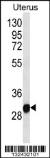RNF148 Antibody (C-term) (Cat. #AP12970b) western blot analysis in human normal Uterus tissue lysates (35ug/lane).This demonstrates the RNF148 antibody detected the RNF148 protein (arrow).