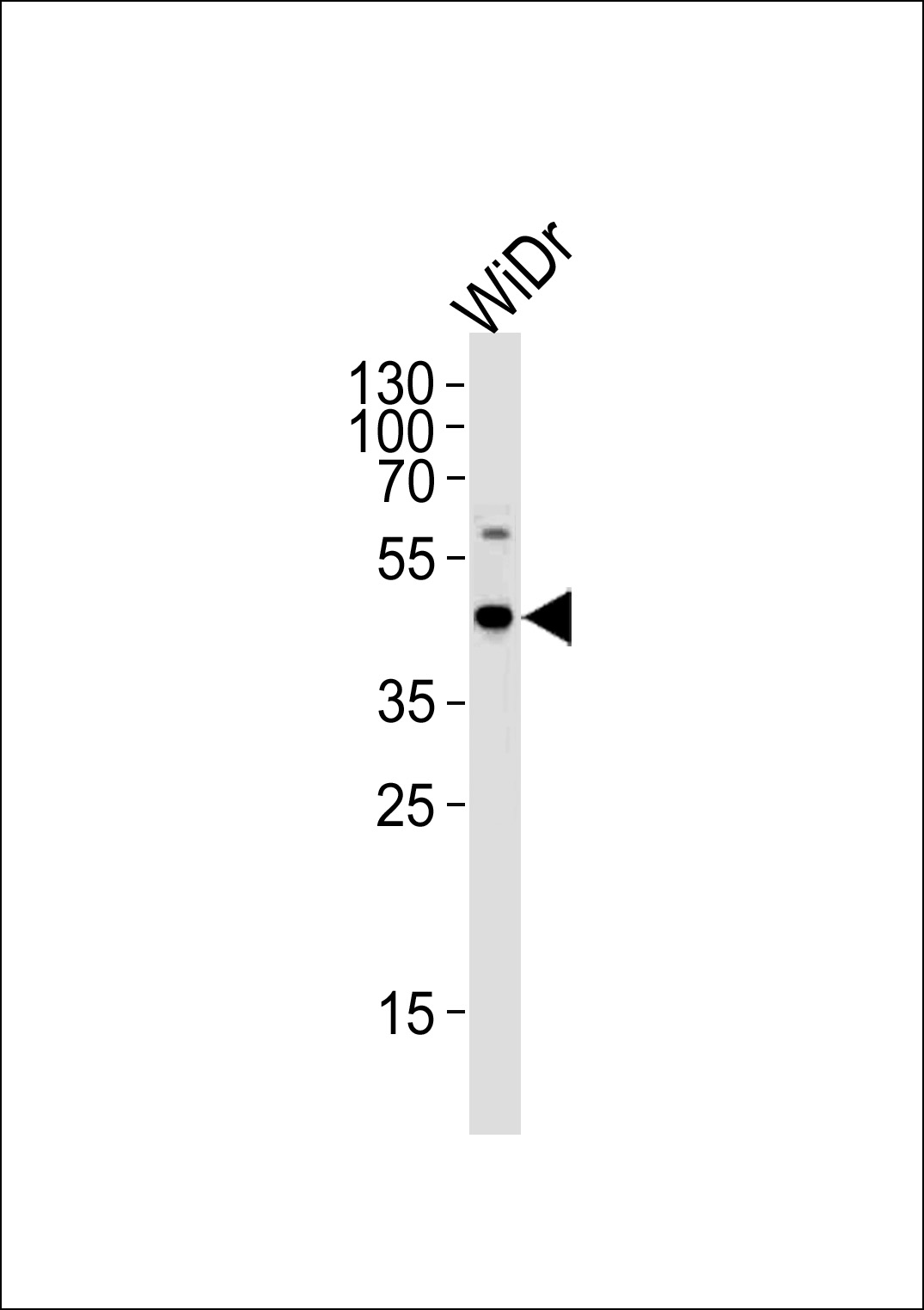 C9orf72 Antibody (C-term) (Cat.# AP12928b) western blot analysis in WiDr cell lysate (35ug/lane). This demonstrates that the C9orf72 antibody detected C9orf72 protein (arrow).