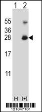 Western blot analysis of RNF11 (arrow) using rabbit polyclonal RNF11 Antibody (Center) (Cat. #AP12908c). 293 cell lysates (2 ug/lane) either nontransfected (Lane 1) or transiently transfected (Lane 2) with the RNF11 gene.