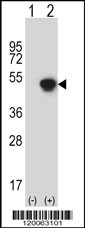Western blot analysis of GCAT (arrow) using rabbit polyclonal GCAT Antibody (N-term) (Cat. #AP12897a). 293 cell lysates (2 ug/lane) either nontransfected (Lane 1) or transiently transfected (Lane 2) with the GCAT gene.