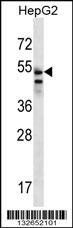 SLC29A3 Antibody (N-term) (Cat. #AP12865a) western blot analysis in HepG2 cell line lysates (35ug/lane).This demonstrates the SLC29A3 antibody detected the SLC29A3 protein (arrow).