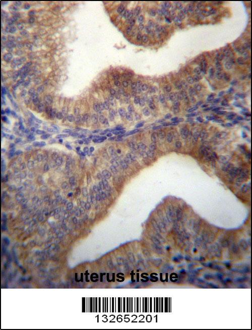 SLC29A3 Antibody (N-term) (Cat. #AP12865a)immunohistochemistry analysis in formalin fixed and paraffin embedded human uterus tissue followed by peroxidase conjugation of the secondary antibody and DAB staining.This data demonstrates the use of SLC29A3 Antibody (N-term) for immunohistochemistry. Clinical relevance has not been evaluated.