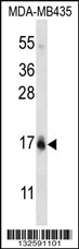 HIST1H2BC/HIST1H2BF Antibody (N-term) (Cat. #AP12846a) western blot analysis in MDA-MB435 cell line lysates (35ug/lane).This demonstrates the HIST1H2BC/HIST1H2BF antibody detected the HIST1H2BC/HIST1H2BF protein (arrow).