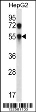 CHST8 Antibody (Center) (Cat. #AP12842c) western blot analysis in HepG2 cell line lysates (35ug/lane).This demonstrates the CHST8 antibody detected the CHST8 protein (arrow).