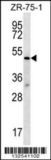 TBL2 Antibody (N-term) (Cat. #AP12833a) western blot analysis in ZR-75-1 cell line lysates (35ug/lane).This demonstrates the TBL2 antibody detected the TBL2 protein (arrow).