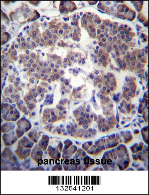 TBL2 Antibody (N-term) (Cat. #AP12833a)immunohistochemistry analysis in formalin fixed and paraffin embedded human pancreas tissue followed by peroxidase conjugation of the secondary antibody and DAB staining.This data demonstrates the use of TBL2 Antibody (N-term) for immunohistochemistry. Clinical relevance has not been evaluated.