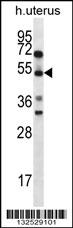 ABRA Antibody (C-term) (Cat. #AP12828b) western blot analysis in human normal Uterus tissue lysates (35ug/lane).This demonstrates the ABRA antibody detected the ABRA protein (arrow).