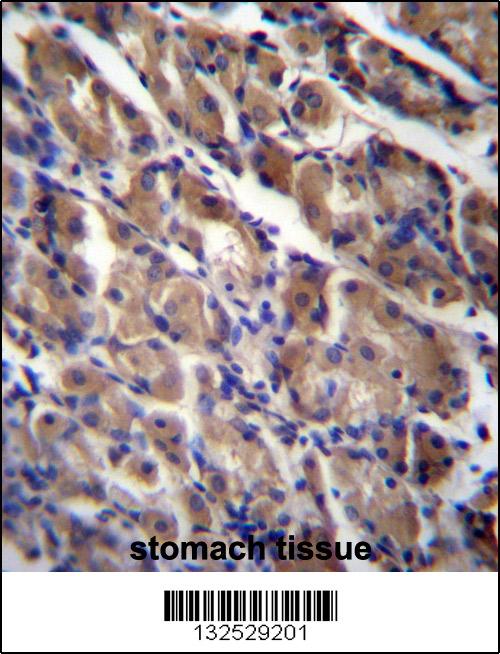 ABRA Antibody (C-term) (Cat. #AP12828b)immunohistochemistry analysis in formalin fixed and paraffin embedded human stomach tissue followed by peroxidase conjugation of the secondary antibody and DAB staining.This data demonstrates the use of ABRA Antibody (C-term) for immunohistochemistry. Clinical relevance has not been evaluated.