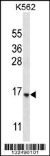 STARD5 Antibody (N-term) (Cat. #AP12823a) western blot analysis in K562 cell line lysates (35ug/lane).This demonstrates the STARD5 antibody detected the STARD5 protein (arrow).