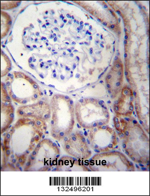 STARD5 Antibody (N-term) (Cat. #AP12823a)immunohistochemistry analysis in formalin fixed and paraffin embedded human kidney tissue followed by peroxidase conjugation of the secondary antibody and DAB staining.This data demonstrates the use of STARD5 Antibody (N-term) for immunohistochemistry. Clinical relevance has not been evaluated.