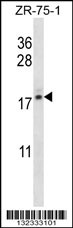 TNP2 Antibody (C-term) (Cat. #AP12809b) western blot analysis in ZR-75-1 cell line lysates (35ug/lane).This demonstrates the TNP2 antibody detected the TNP2 protein (arrow).