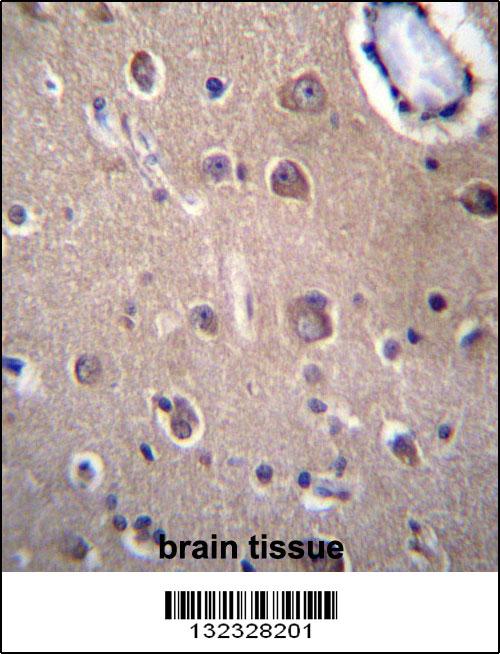 SLC8A3 Antibdy (C-term) (Cat. #AP12808b)immunohistochemistry analysis in formalin fixed and paraffin embedded human brain tissue followed by peroxidase conjugation of the secondary antibody and DAB staining.This data demonstrates the use of SLC8A3 Antibdy (C-term) for immunohistochemistry. Clinical relevance has not been evaluated.