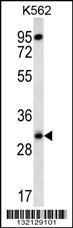 RPS4Y1 Antibody (Center) (Cat. #AP12803c) western blot analysis in K562 cell line lysates (35ug/lane).This demonstrates the RPS4Y1 antibody detected the RPS4Y1 protein (arrow).