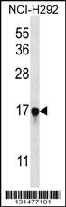PAGE5 Antibody (C-term) (Cat. #AP12792b) western blot analysis in NCI-H292 cell line lysates (35ug/lane).This demonstrates the PAGE5 antibody detected the PAGE5 protein (arrow).