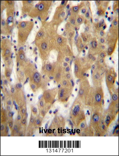 PAGE5 Antibody (C-term) (Cat. #AP12792b)immunohistochemistry analysis in formalin fixed and paraffin embedded human liver tissue followed by peroxidase conjugation of the secondary antibody and DAB staining.This data demonstrates the use of PAGE5 Antibody (C-term) for immunohistochemistry. Clinical relevance has not been evaluated.