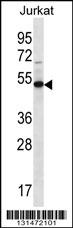 FA8A1 Antibody (N-term) (Cat. #AP12791a) western blot analysis in Jurkat cell line lysates (35ug/lane).This demonstrates the FA8A1 antibody detected the FA8A1 protein (arrow).