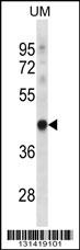 TRUB1 Antibody (Center) (Cat. #AP12789c) western blot analysis in uterus tumor cell line lysates (35ug/lane).This demonstrates the TRUB1 antibody detected the TRUB1 protein (arrow).