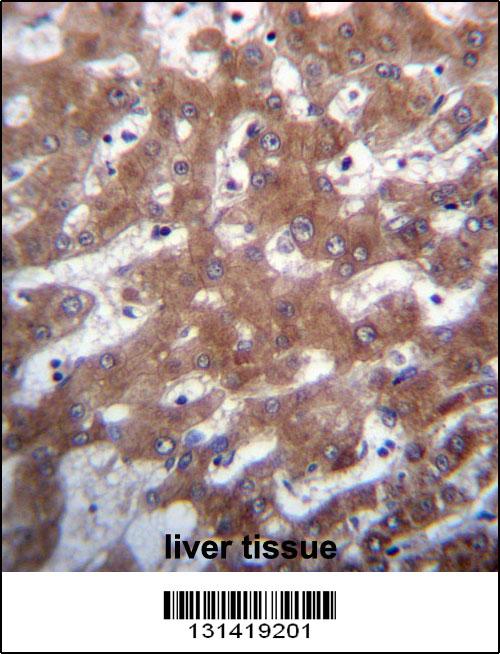 TRUB1 Antibody (Center) (Cat. #AP12789c)immunohistochemistry analysis in formalin fixed and paraffin embedded human liver tissue followed by peroxidase conjugation of the secondary antibody and DAB staining.This data demonstrates the use of TRUB1 Antibody (Center) for immunohistochemistry. Clinical relevance has not been evaluated.