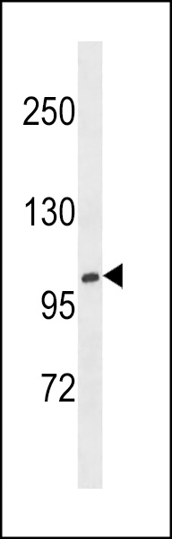 XYLT1 Antibody (N-term) (Cat. #AP12779a) western blot analysis in NCI-H460 cell line lysates (35ug/lane).This demonstrates the XYLT1 antibody detected the XYLT1 protein (arrow).