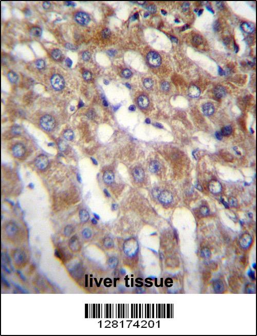 BEND7 Antibody (C-term) (Cat. #AP12776b)immunohistochemistry analysis in formalin fixed and paraffin embedded human liver tissue followed by peroxidase conjugation of the secondary antibody and DAB staining.This data demonstrates the use of BEND7 Antibody (C-term) for immunohistochemistry. Clinical relevance has not been evaluated.