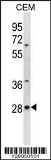 ALKBH4 Antibody (Center) (Cat. #AP12774c) western blot analysis in CEM cell line lysates (35ug/lane).This demonstrates the ALKBH4 antibody detected the ALKBH4 protein (arrow).