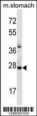 ALKBH4 Antibody (Center) (Cat. #AP12774c) western blot analysis in mouse stomach tissue lysates (35ug/lane).This demonstrates the ALKBH4 antibody detected the ALKBH4 protein (arrow).