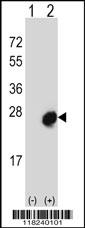 Western blot analysis of MID1IP1 (arrow) using rabbit polyclonal MID1IP1 Antibody (N-term) (Cat. #AP12762a). 293 cell lysates (2 ug/lane) either nontransfected (Lane 1) or transiently transfected (Lane 2) with the MID1IP1 gene.