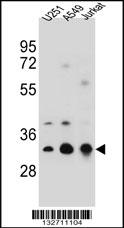 TPM4 Antibody (N-term) (Cat. #AP12756a) western blot analysis in U251,A549,Jurkat cell line lysates (35ug/lane).This demonstrates the TPM4 antibody detected the TPM4 protein (arrow).