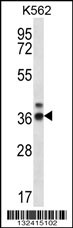 RPP38 Antibody (C-term) (Cat. #AP12741b) western blot analysis in K562 cell line lysates (35ug/lane).This demonstrates the RPP38 antibody detected the RPP38 protein (arrow).
