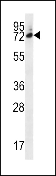 SIX5 Antibody (Center) (Cat. #AP12740c) western blot analysis in MDA-MB231 cell line lysates (35ug/lane).This demonstrates the SIX5 antibody detected the SIX5 protein (arrow).