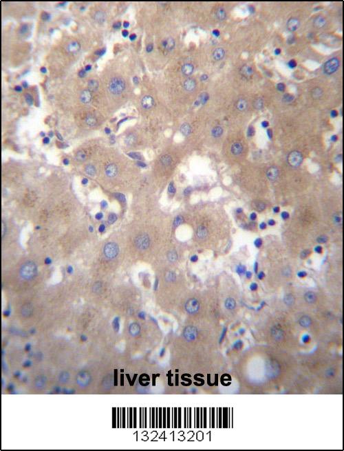 SIX5 Antibody (Center) (Cat. #AP12740c)immunohistochemistry analysis in formalin fixed and paraffin embedded human liver tissue followed by peroxidase conjugation of the secondary antibody and DAB staining.This data demonstrates the use of SIX5 Antibody (Center) for immunohistochemistry. Clinical relevance has not been evaluated.