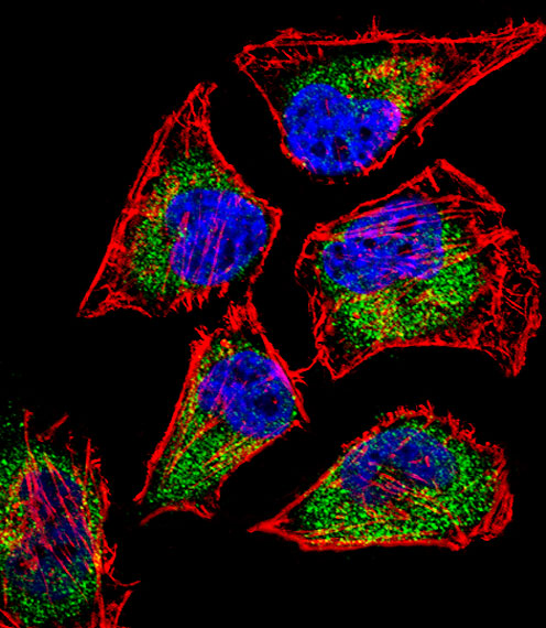 Fluorescent confocal image of Hela cell stained with SIX5 Antibody (Center)(Cat#AP12740c).Hela cells were fixed with 4% PFA (20 min), permeabilized with Triton X-100 (0.1%, 10 min), then incubated with SIX5 primary antibody (1:25, 1 h at 37℃). For secondary antibody, Alexa Fluor® 488 conjugated donkey anti-rabbit antibody (green) was used (1:400, 50 min at 37℃).Cytoplasmic actin was counterstained with Alexa Fluor® 555 (red) conjugated Phalloidin (7units/ml, 1 h at 37℃). Nuclei were counterstained with DAPI (blue) (10 µg/ml, 10 min). SIX5 immunoreactivity is localized to Cytoplasm significantly.