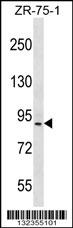 HRC Antibody (Center) (Cat. #AP12729c) western blot analysis in ZR-75-1 cell line lysates (35ug/lane).This demonstrates the HRC antibody detected the HRC protein (arrow).
