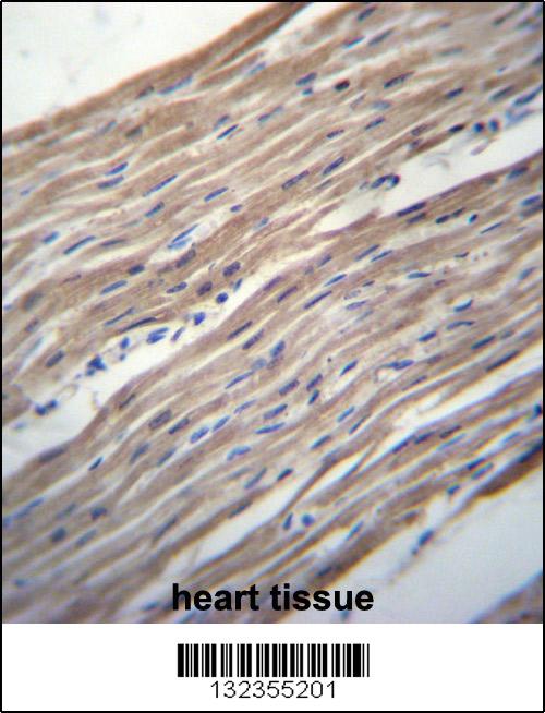 HRC Antibody (Center) (Cat. #AP12729c)immunohistochemistry analysis in formalin fixed and paraffin embedded human heart tissue followed by peroxidase conjugation of the secondary antibody and DAB staining.This data demonstrates the use of HRC Antibody (Center) for immunohistochemistry. Clinical relevance has not been evaluated.