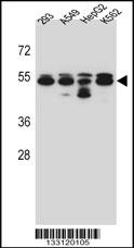 TUBB8 Antibody (N-term) (Cat. #AP13248a) western blot analysis in 293,A549,HepG2,K562 cell line lysates (35ug/lane).This demonstrates the TUBB8 antibody detected the TUBB8 protein (arrow).