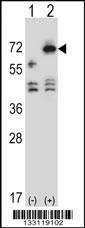 Western blot analysis of ARSF (arrow) using rabbit polyclonal ARSF Antibody (Center) (Cat. #AP13247c). 293 cell lysates (2 ug/lane) either nontransfected (Lane 1) or transiently transfected (Lane 2) with the ARSF gene.