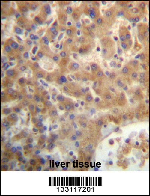 SEC14L4 Antibody (N-term) (Cat. #AP13245a)immunohistochemistry analysis in formalin fixed and paraffin embedded human liver tissue followed by peroxidase conjugation of the secondary antibody and DAB staining.This data demonstrates the use of SEC14L4 Antibody (N-term) for immunohistochemistry. Clinical relevance has not been evaluated.