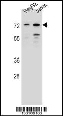 DACH2 Antibody (N-term) (Cat. #AP13241a) western blot analysis in HepG2,Jurkat cell line lysates (35ug/lane).This demonstrates the DACH2 antibody detected the DACH2 protein (arrow).