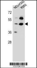 SC65 Antibody (C-term) (Cat. #AP13238b) western blot analysis in NCI-H292,K562 cell line lysates (35ug/lane).This demonstrates the SC65 antibody detected the SC65 protein (arrow).